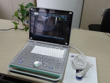 3D Digitale Laptop Draagbare Ultrasone klankscanner met Allerlei Sonde